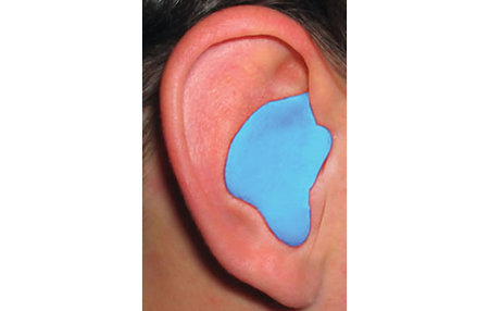 RADIANS One Pair of Custom Molded Earplugs (Blue) 26NRR